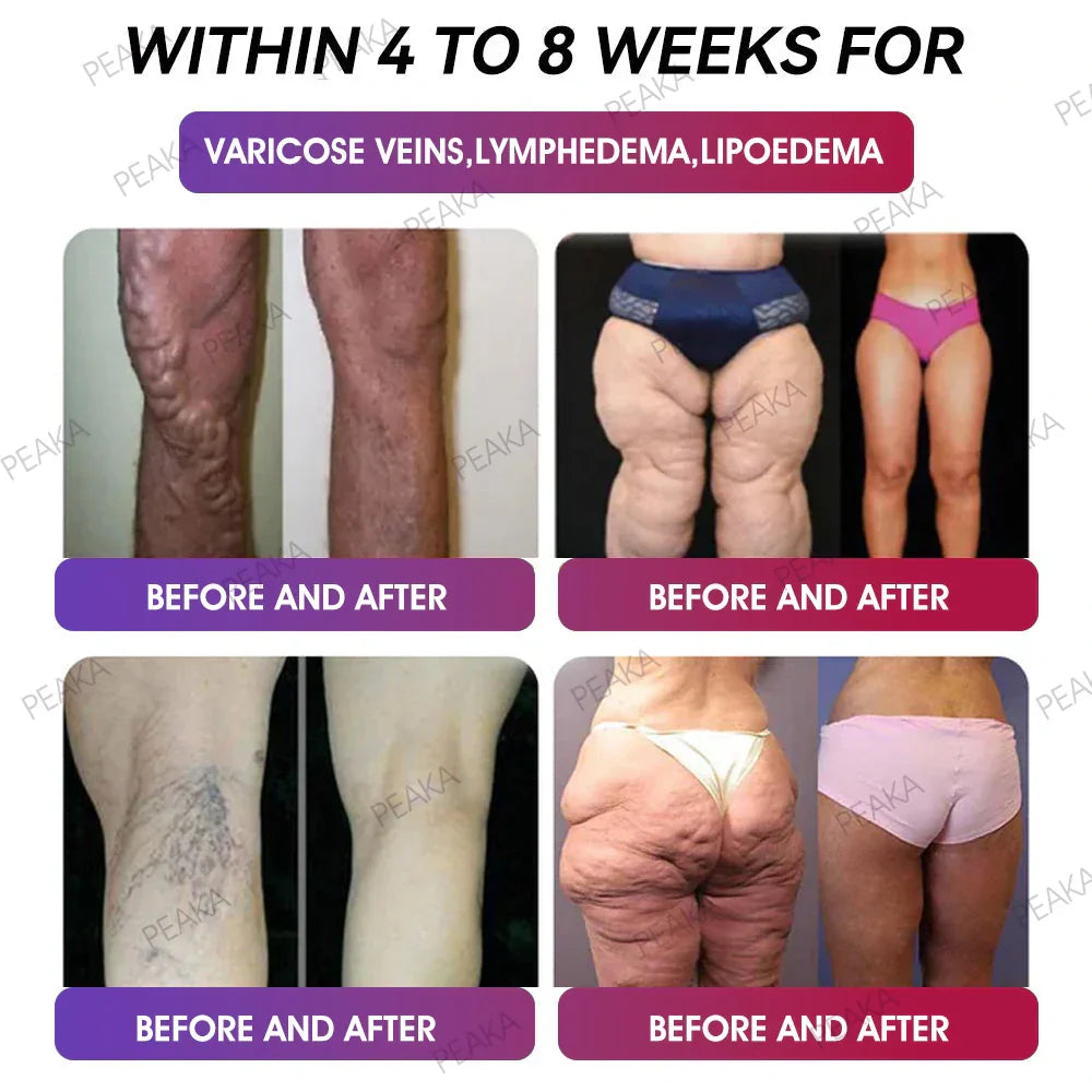 PEAKA® GLP‑1 Slimming Vitality Boost Oral Strips 👩⚕️🥇(Just once a week, visible changes in 7 days ✅ For obesity, cardiovascular health, diabetes, sleep apnea, joint issues, and more)