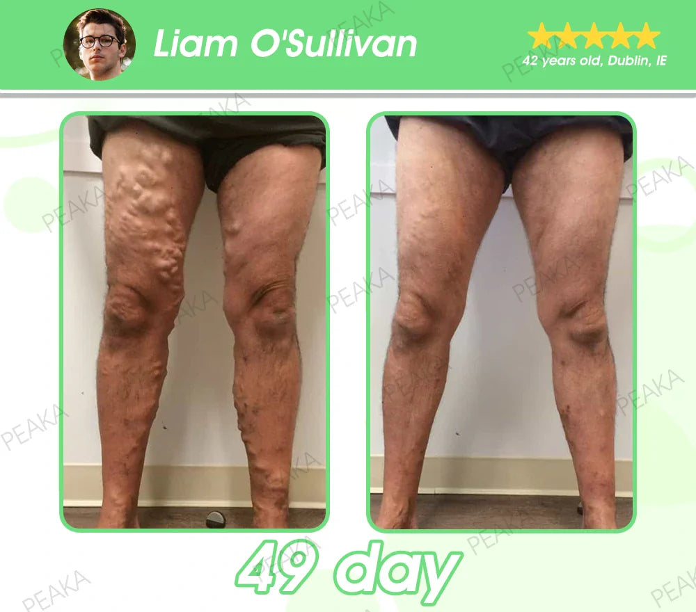 | 𝐋𝐚𝐬𝐭 𝐃𝐚𝐲 𝐏𝐫𝐨𝐦𝐨𝐭𝐢𝐨𝐧 𝟖𝟎% 𝐎𝐅𝐅 | 𝐏𝐄𝐀𝐊𝐀® 🇮🇪𝐆𝐋𝐏-𝟏 𝐒𝐈𝐗-𝐈𝐍-𝐎𝐍𝐄 𝗦𝗹𝗶𝗺𝗺𝗶𝗻𝗴 & 𝗛𝗲𝗮𝗹𝘁𝗵 𝗘𝘀𝘀𝗲𝗻𝗰𝗲 𝗟𝗶𝗾𝘂𝗶𝗱 𝗣𝗲𝗮𝗿𝗹𝘀 — 𝗡𝗔𝗗+𝐌𝐨𝐫𝐢𝐧𝐠𝐚 & 𝐀𝐂𝐕 & 𝐊𝐞𝐭𝐨 𝐁𝐇𝐁 (✅ 𝐅𝐨𝐫 𝐨𝐛𝐞𝐬𝐢𝐭𝐲, 𝐜𝐚𝐫𝐝𝐢𝐨𝐯𝐚𝐬𝐜𝐮𝐥𝐚𝐫 𝐡𝐞𝐚𝐥𝐭𝐡, 𝐝𝐢𝐚𝐛𝐞𝐭𝐞𝐬, 𝐬𝐥𝐞𝐞𝐩 𝐚𝐩𝐧𝐞𝐚, 𝐆𝐮𝐭 𝐇𝐞𝐚𝐥𝐭𝐡, 𝐣𝐨𝐢𝐧𝐭 𝐢𝐬𝐬𝐮𝐞𝐬, 𝐚𝐧𝐝 𝐦𝐨𝐫𝐞